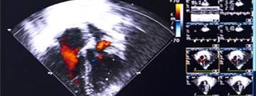 3d echo test 3d echo test