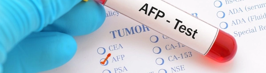 Alpha-Fetoprotein (AFP) Test Alpha-Fetoprotein (AFP) Test