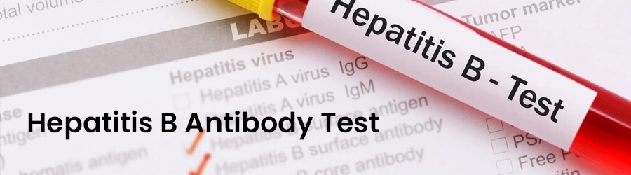 Hepatitis B antibody Hepatitis B antibody