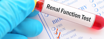 Kidney Function Test (KFT)