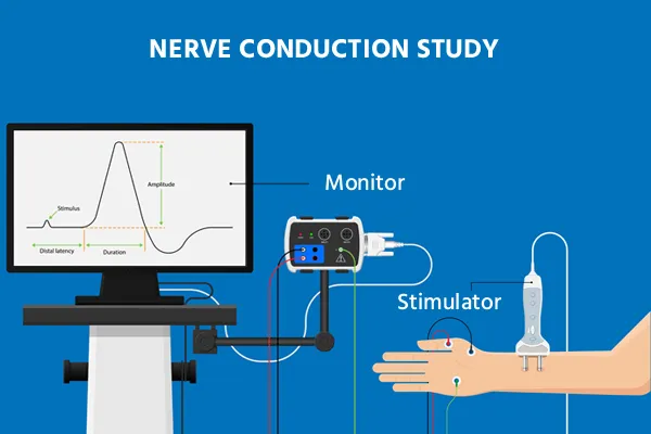 EMG/NCV Test EMG/NCV Test
