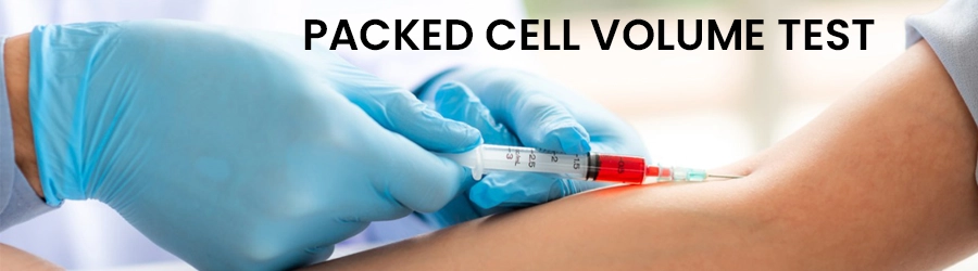 Packed Cell Volume Test Packed Cell Volume Test