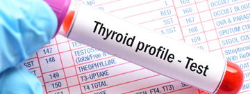 thyroid profile test thyroid profile test