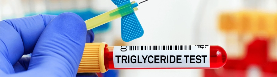 Triglycerides test Triglycerides test