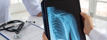 x-ray test x-ray test