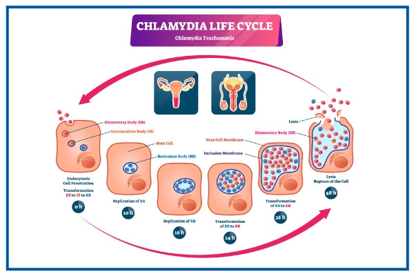Chlamydia Infection