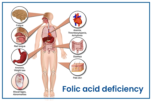 Folic Acid Deficiency