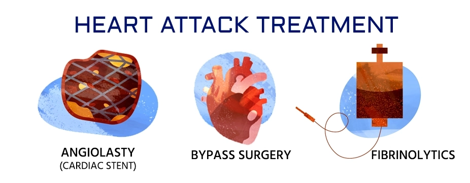 Treatment for Heart Attack