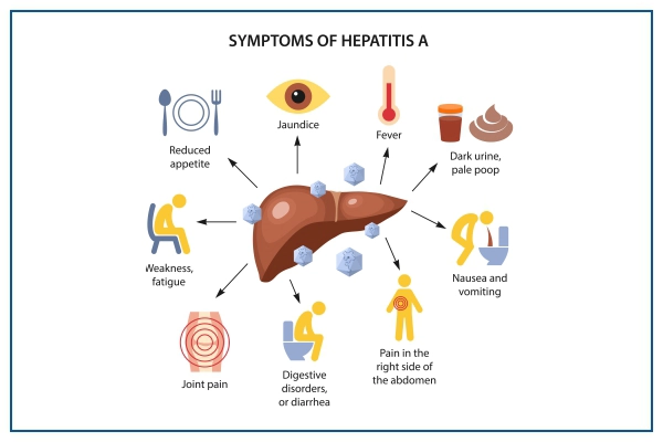 Hepatitis A