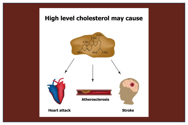 High Cholesterol Causes