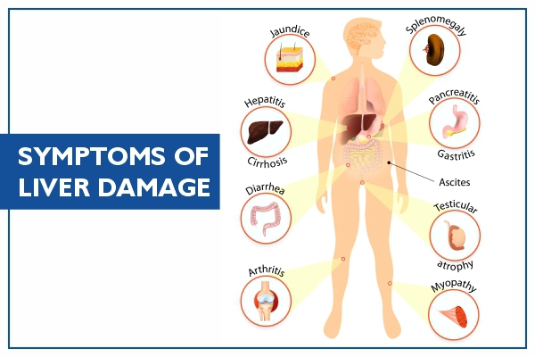 liver-cancer-symptoms