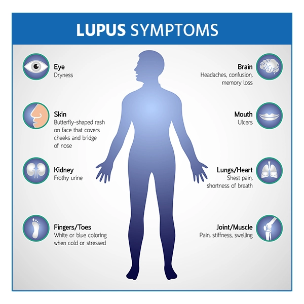 lupus symptoms