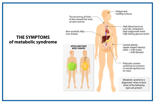 Symptoms of Metabolic Syndrome