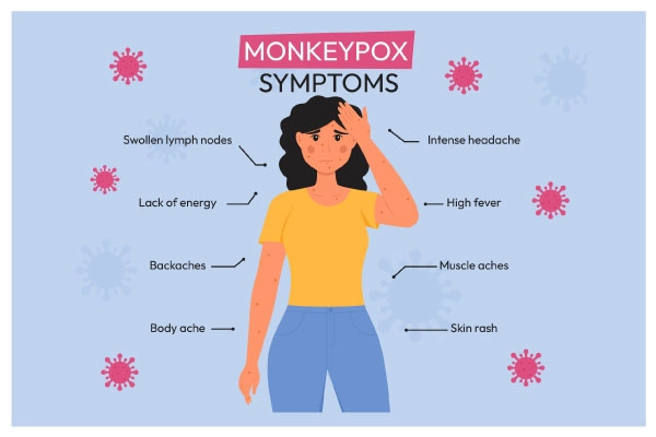 Monkeypox Symptoms