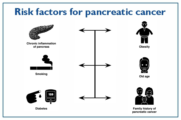 risk factors for pancreatic cancer