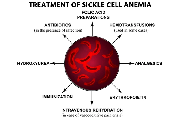 Treatment of Sickle Cell Anemia