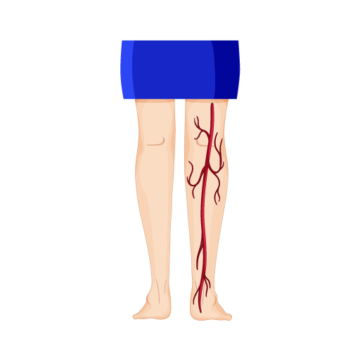 Get Vascular Surgery in Nizamabad