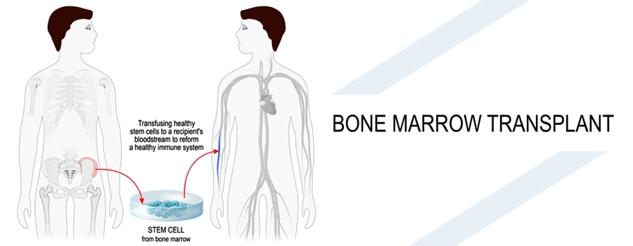 Bone Marrow Aspiration and Biopsy