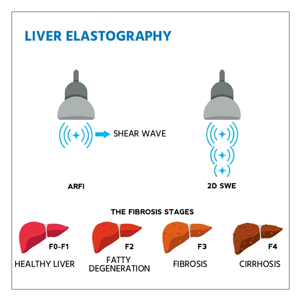 Liver Elastography