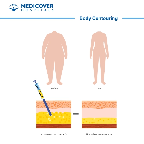 Body Contouring