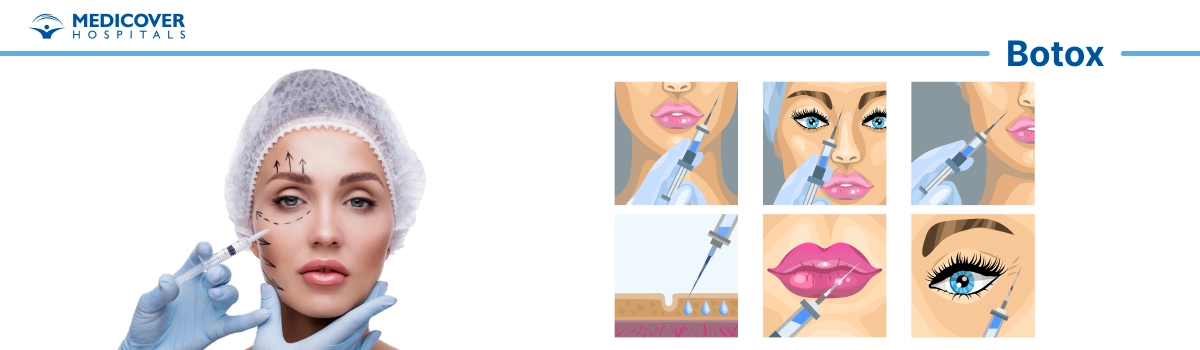 Botox