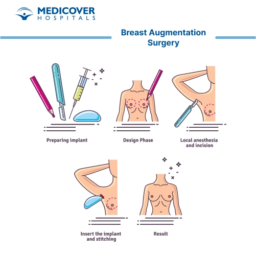 Breast Augmentation