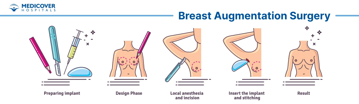 Breast Augmentation