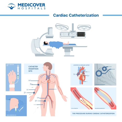 Cardiac catheterization