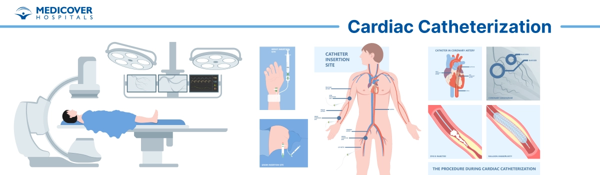 Cardiac catheterization