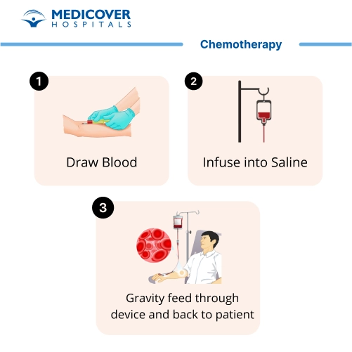 Chemotherapy