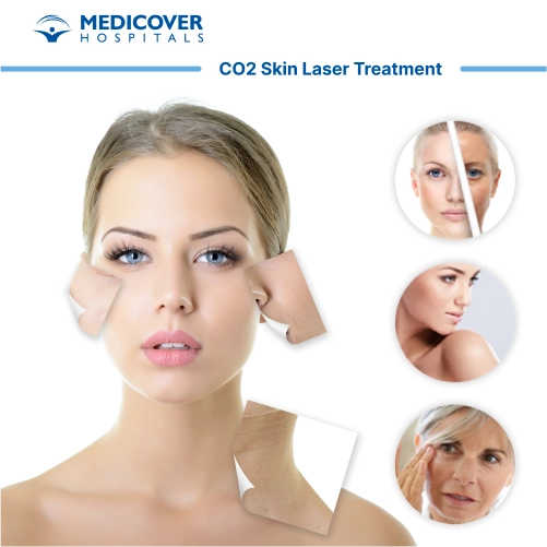 CO2 laser for scars