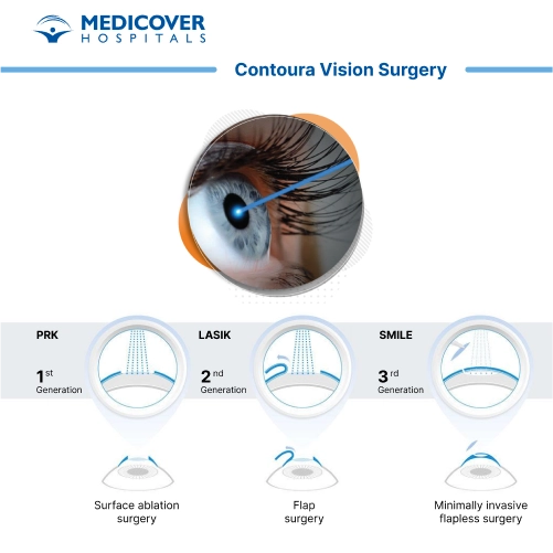 Contoura Vision