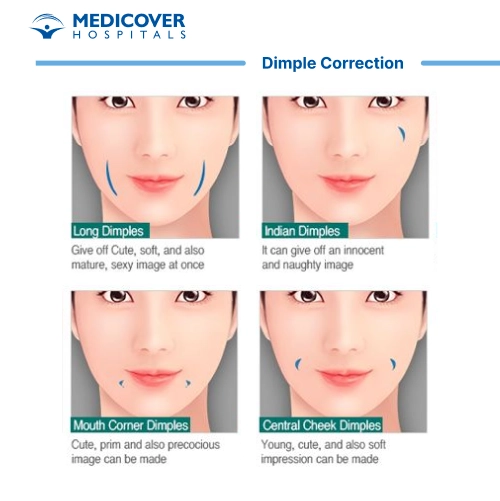 Dimple Correction Surgery
