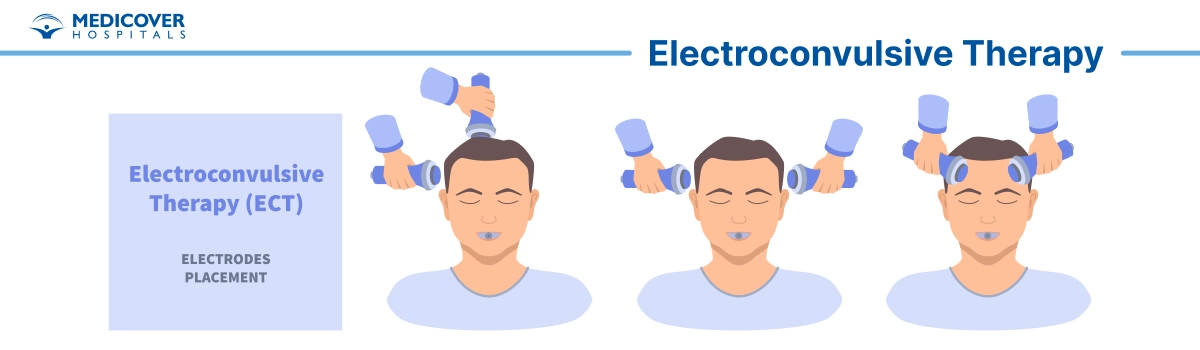 Electroconvulsive Therapy