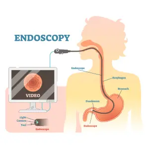 Endoscopy