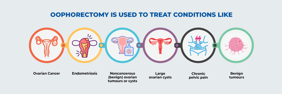 Oophorectomy Cost Oophorectomy Cost