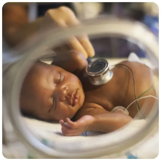 preterm-baby