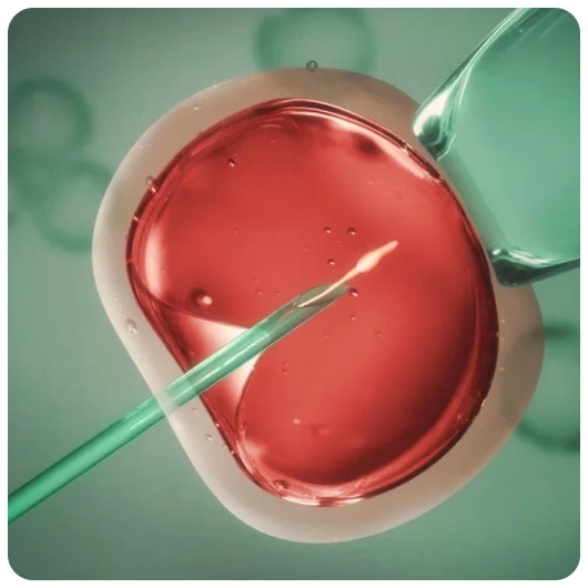 IVF With Donor Egg