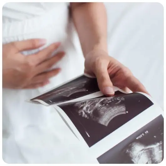 Preeclampsia Screening