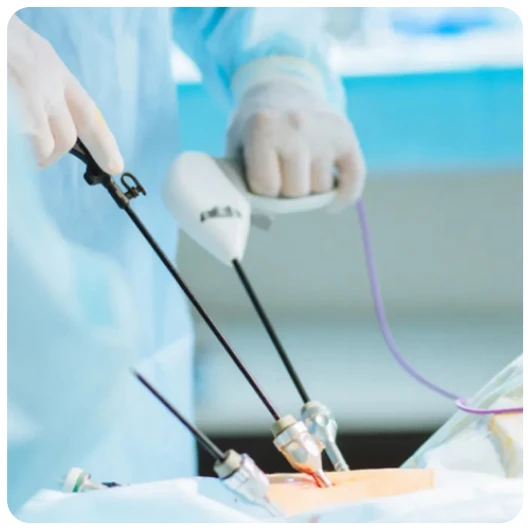 Hysteroscopy