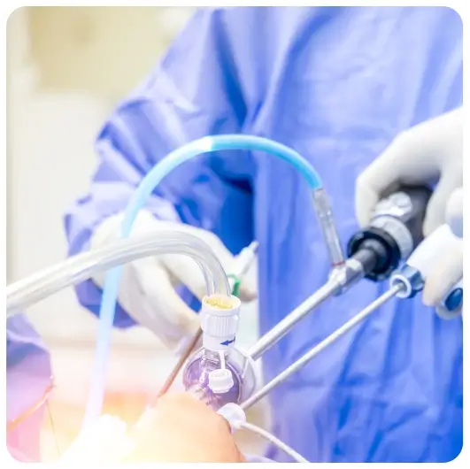 Laparoscopic Surgery