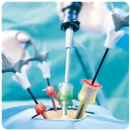 Minimally Invasive Gynecologic Surgery